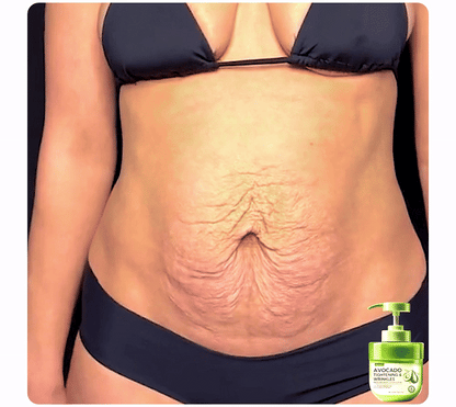 Avocado Tightening & Wrinkles Reducing Body Lotion Scrub