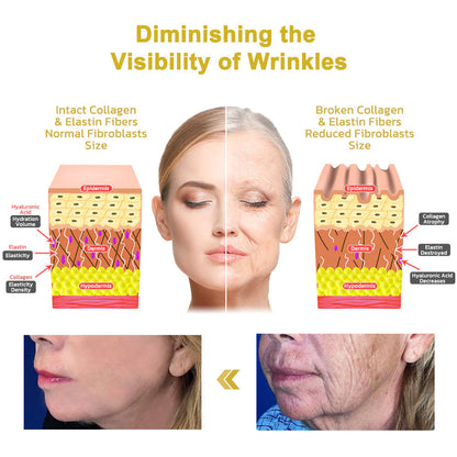 ✨Last Day Discount:75% OFF🌸Negusy™ Advanced Firming & Wrinkle-Reducing Cream: Restore Skin Elasticity🌐