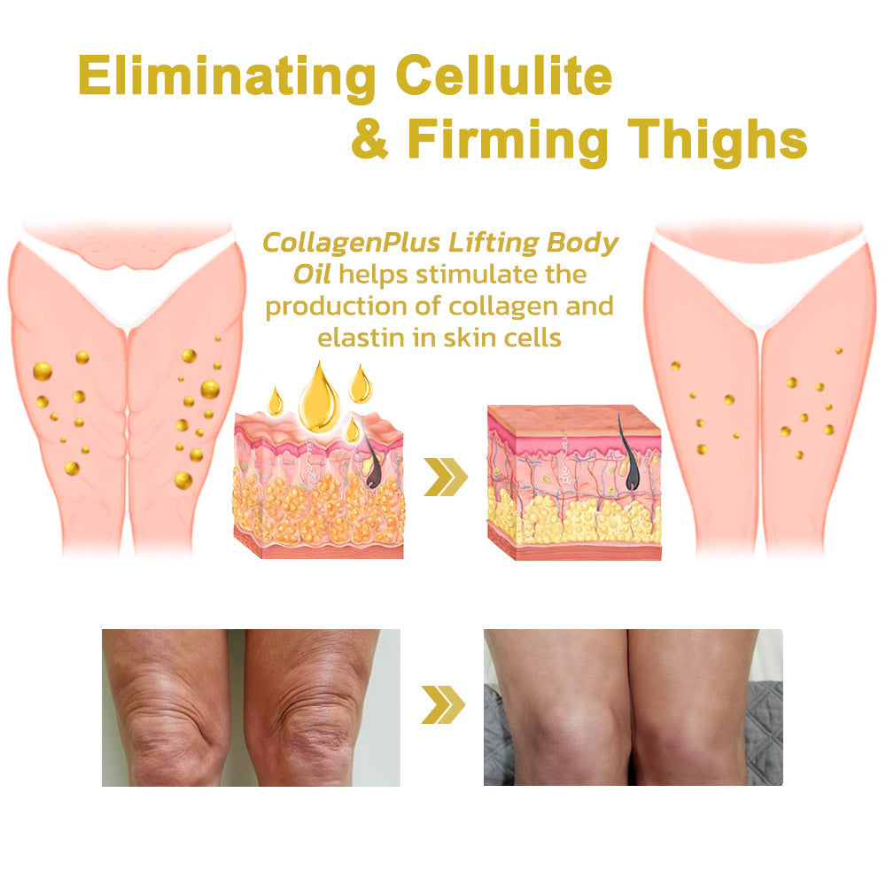 ✨Last Day Discount:75% OFF🌸Negusy™ Advanced Firming & Wrinkle-Reducing Cream: Restore Skin Elasticity🌐